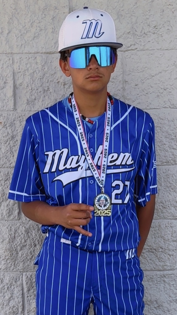 Anthony Valenzuela